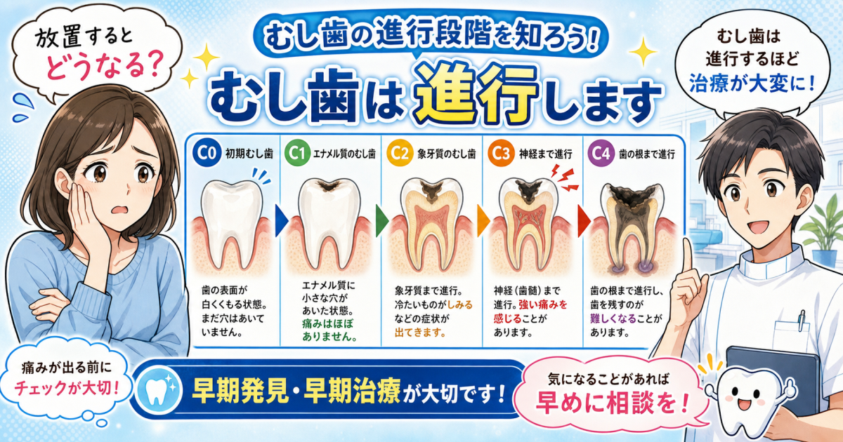 むし歯を放置するとどうなる?歯を失う前に知っておきたいリスク