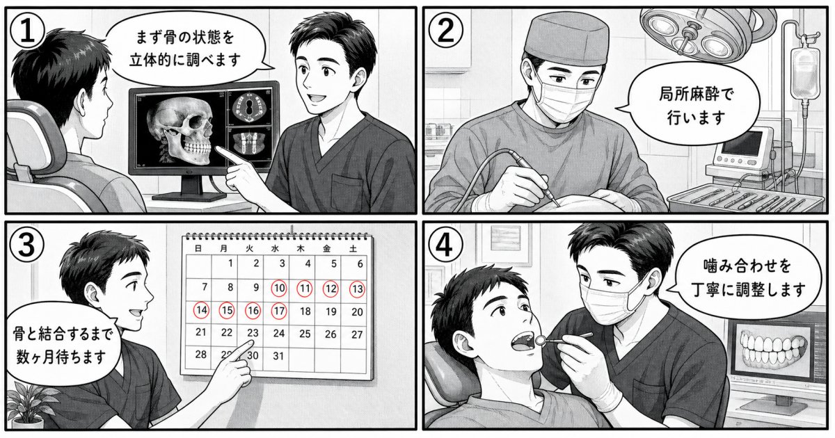人工歯根を支える3重構造と骨と結合する生体力学的仕組み