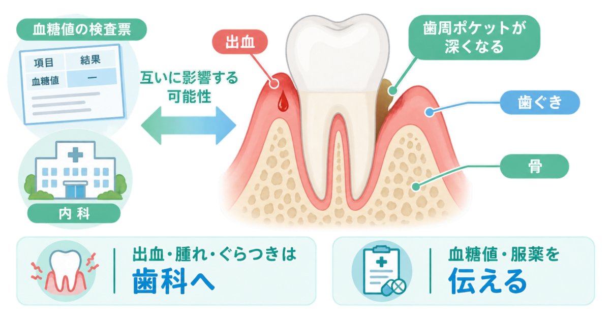 歯ぐきの出血が続く方へ｜歯周病と糖尿病・全身への影響と受診の目安