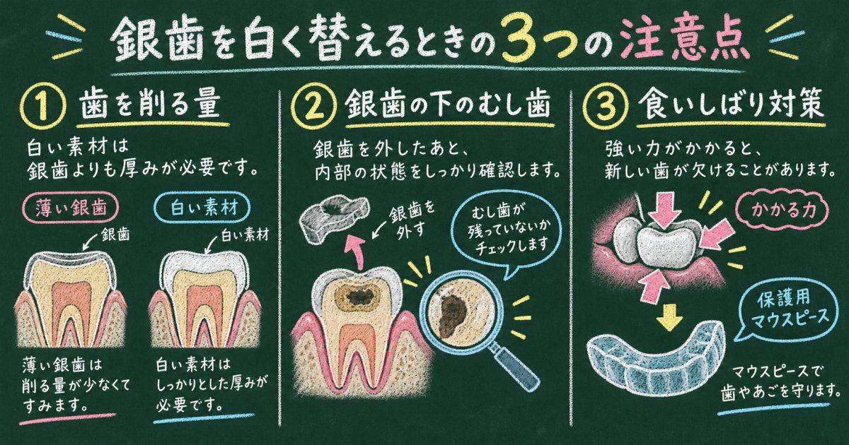 銀歯を交換するときの注意点｜歯を削る量・むし歯・食いしばりによる破損